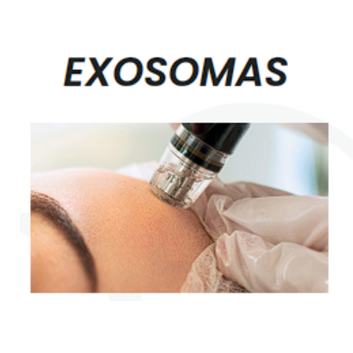 Exoxomas