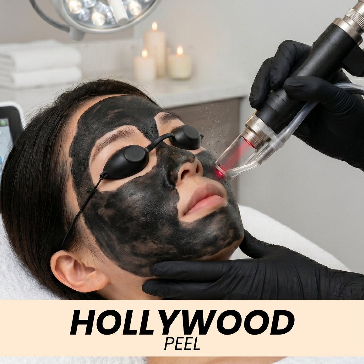 HOLLYWOOD PEEL