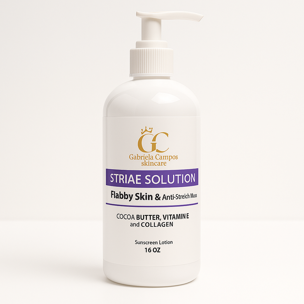 Striae Solution